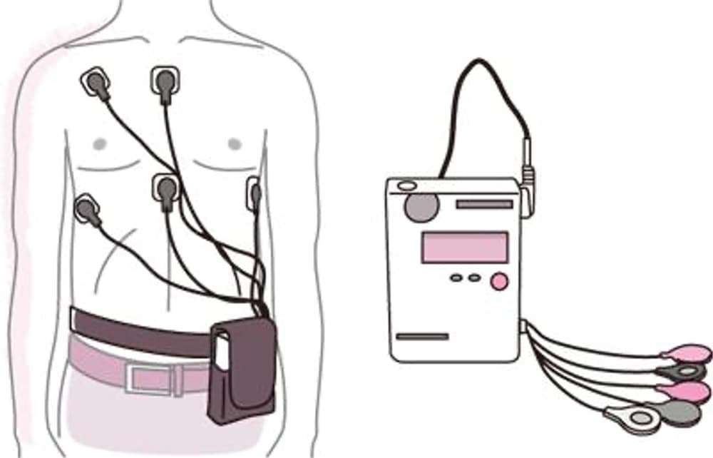 かつてのホルター心電図。器械も大きく、電極も多かった。